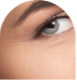 oci